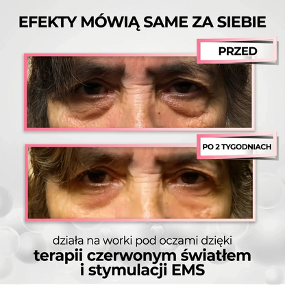 LumiEye Pro™ 2w1 - terapia czerwonym światłem + EMS na worki pod oczami